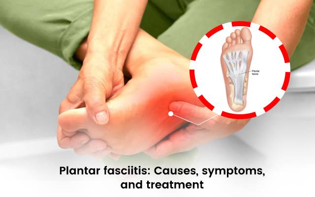 The Ultimate Guide to the Best Insoles for Plantar Fasciitis