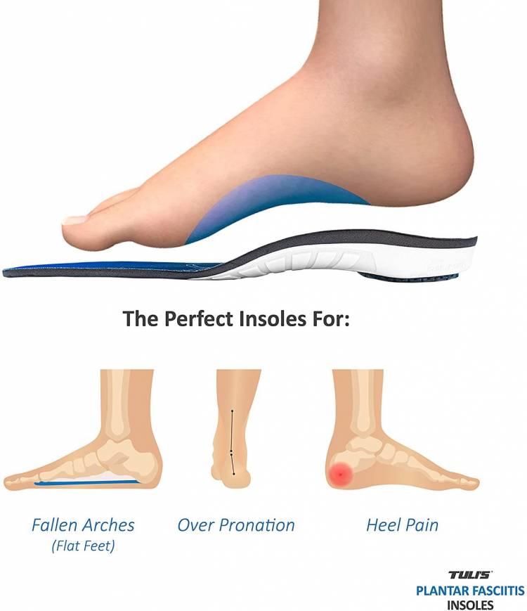 The Ultimate Guide to the Best Insoles for Plantar Fasciitis