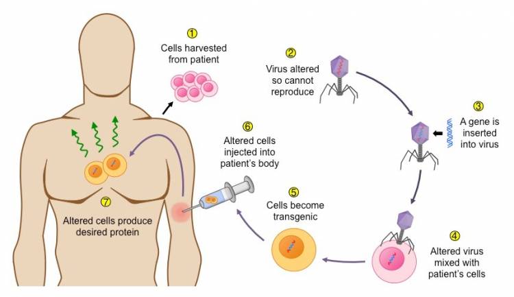 Viral vector Gene Therapy