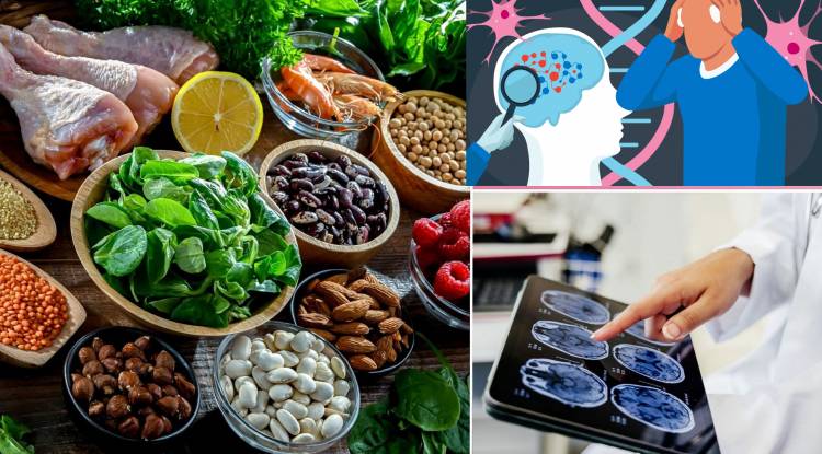 Healthy Eating in Certain Decades May Reduce the Risk of Dementia.