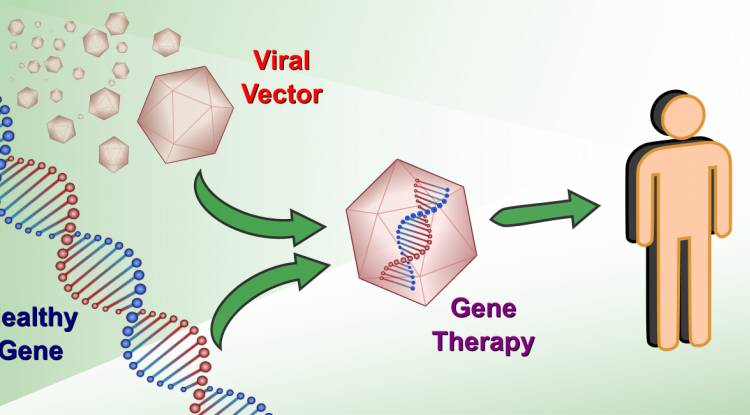 Viral vector Gene Therapy