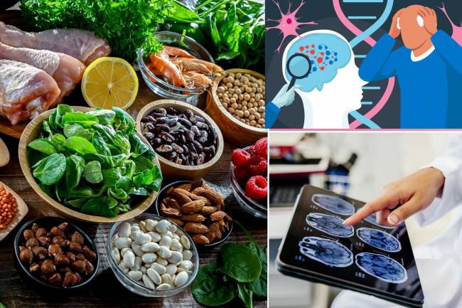 Healthy Eating in Certain Decades May Reduce the Risk of Dementia.