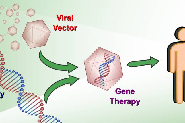Viral vector Gene Therapy